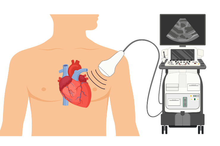 Echocardiography